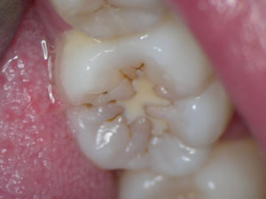 Low magnification dentistry